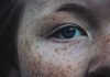 Sunspots on Skin: Cures and Preventive Measures Sunspots on Skin