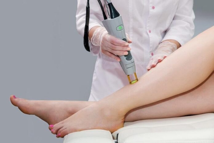 Questions About Laser Hair Removal