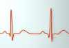 Good Resting Heart Rate good resting heart rate