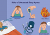 Signs of Sleep Apnea – Its Causes and Cure signs of sleep apnea