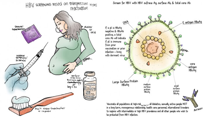 what is hepatitis b