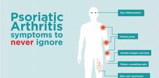 What Is Psoriatic Arthritis what is psoriatic arthritis