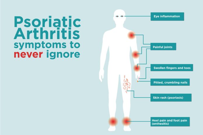 what is psoriatic arthritis