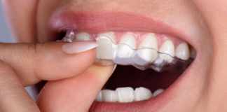 Dental Decoded: 3 Tips To Maintain And Care For Your Aligners Care For Aligners