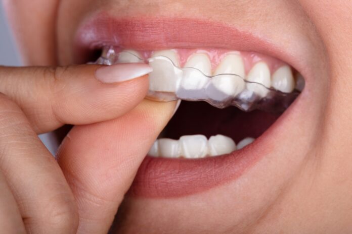 Care For Aligners