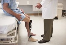 The Aftermath of an Amputation Injury