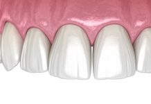 Sedation Dentistry Near Me: How Sunshine Dentistry Helps Nervous Patients Feel at Ease